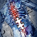 complex spine surgeries