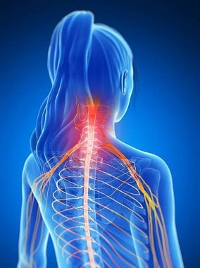 Cervical Radiculopathy Causes Symptoms Treatment Spine Orthopedic