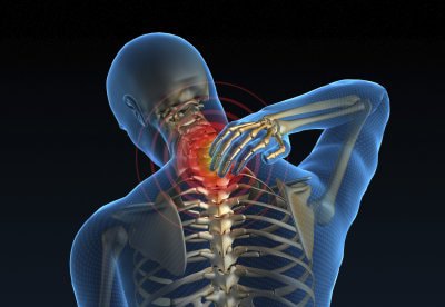 causas del dolor en el cuello