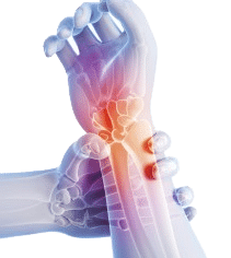 wrist-tendonitis 