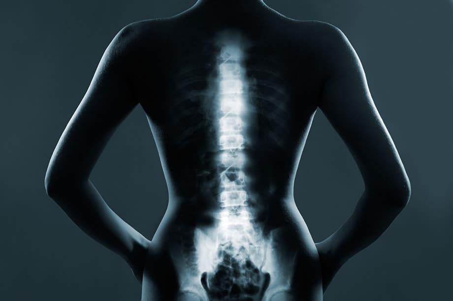How-to-prepare-for-spine-surgery
