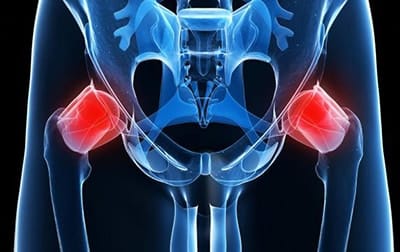 what causes hip pain
