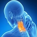 neck pain condition