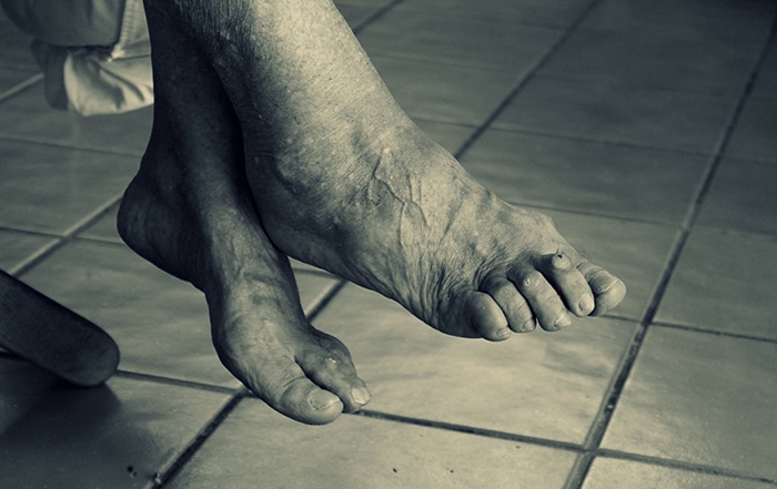 Foot Problems That Come With Aging Spine And Orthopedic Center
