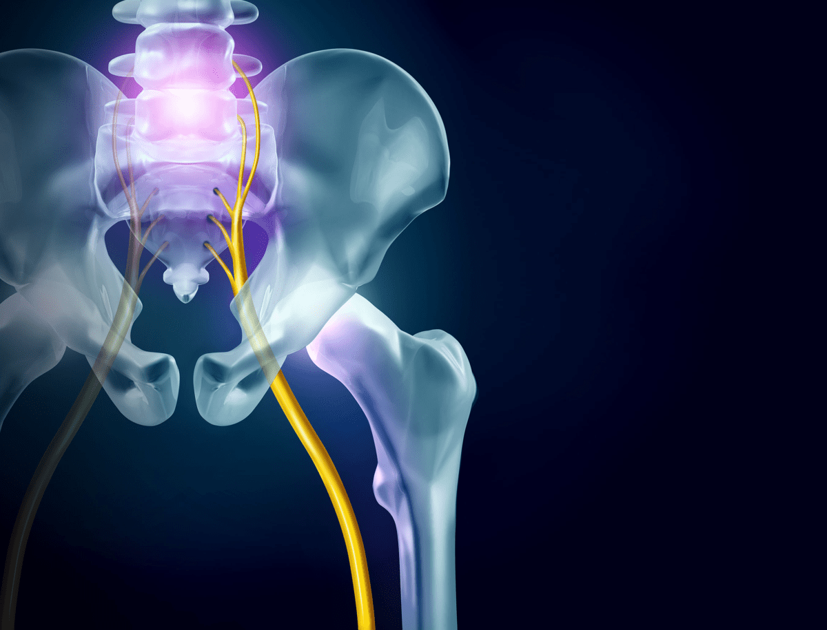 Best Pillows & Sleep Positions For Sciatica Spine & Orthopedic Center