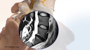 Fluro Spine Diagram